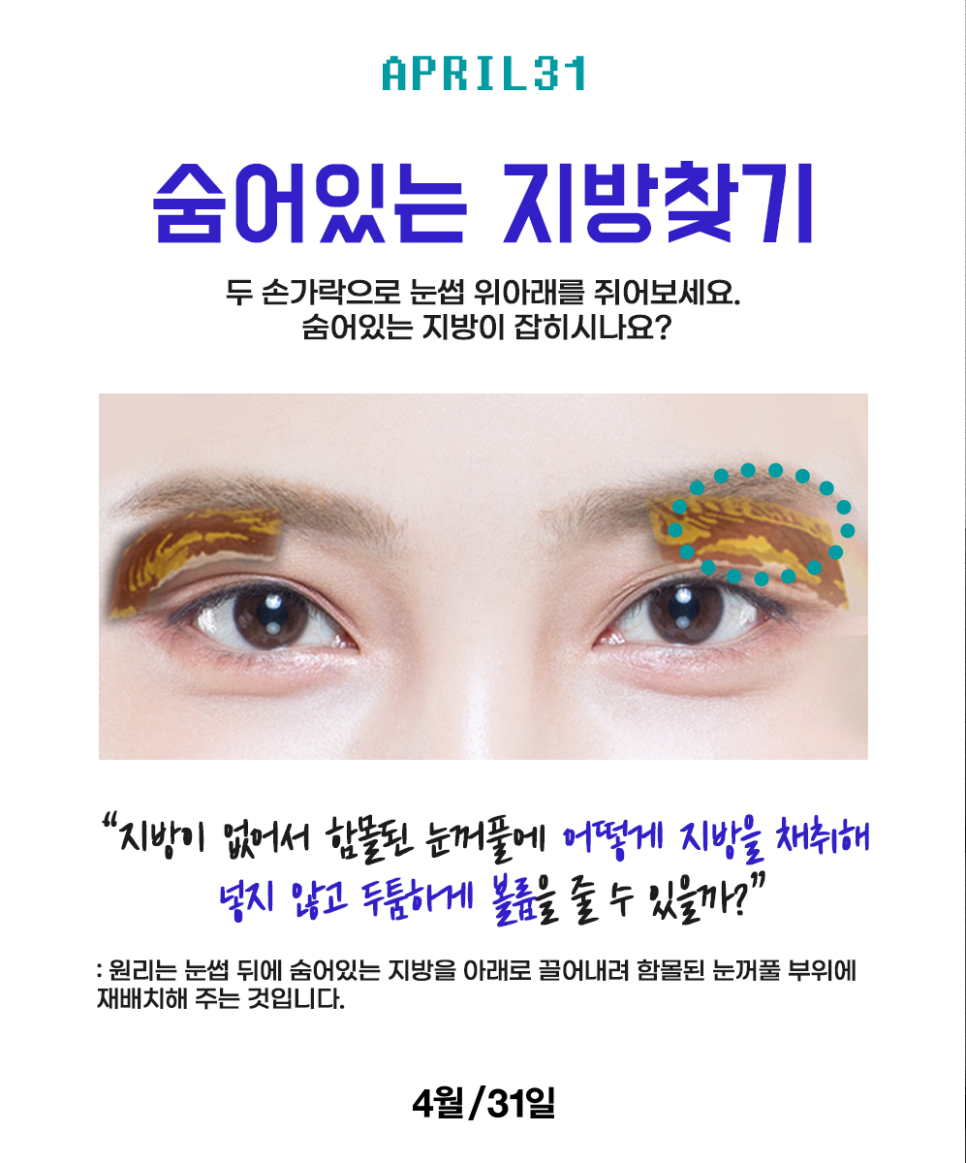 꺼진눈성형비용 시원하고 동안눈매를 원한다면 관련 이미지 3