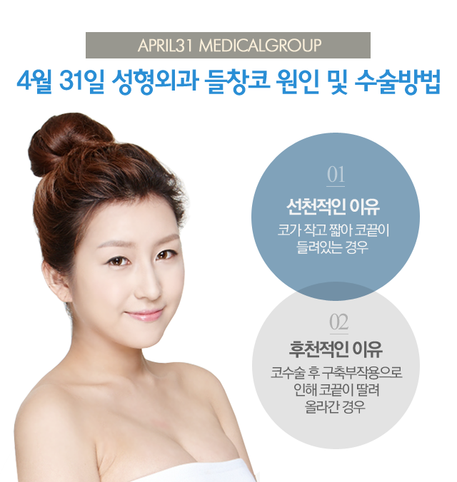 들창코성형후기 믿음 가는 4월31일성형외과의원 관련 이미지 3