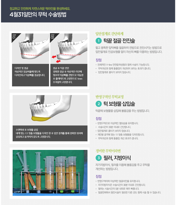 무턱수술비용 4월31일성형외과와 상담하세요 관련 이미지 3