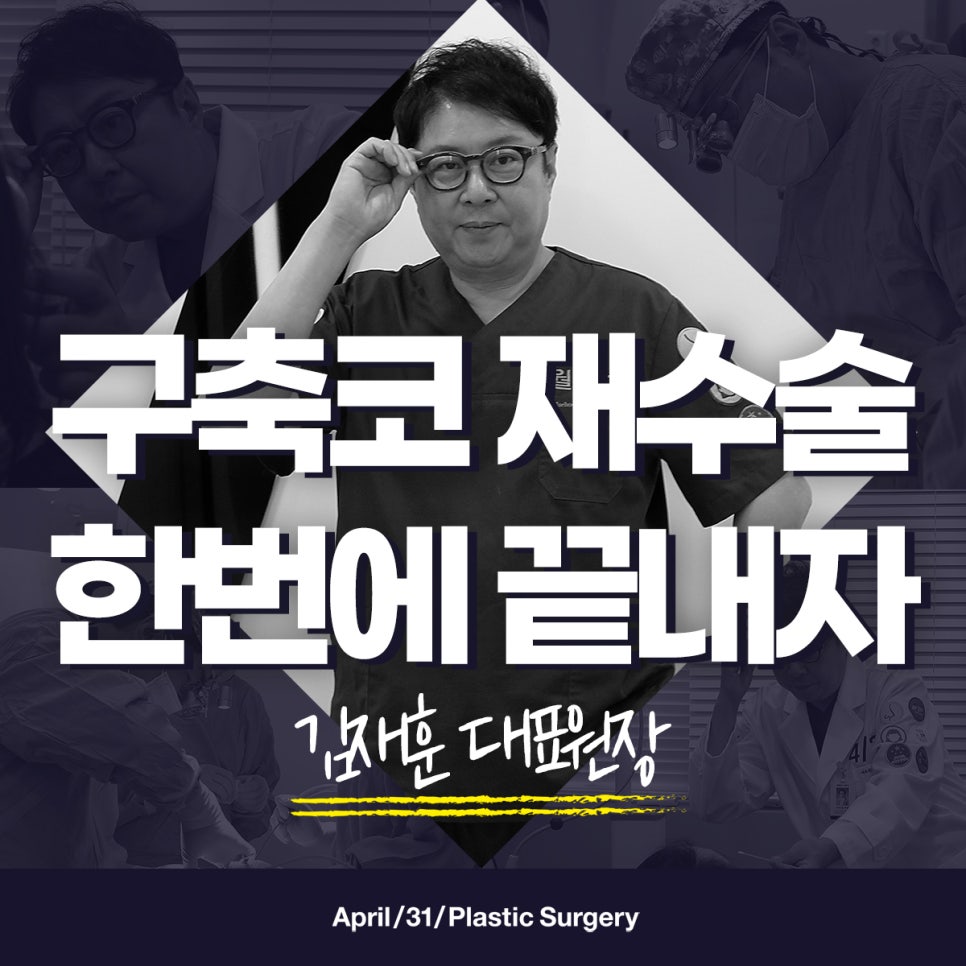 코재수술 실패없는 마지막 기회! 관련 이미지 1