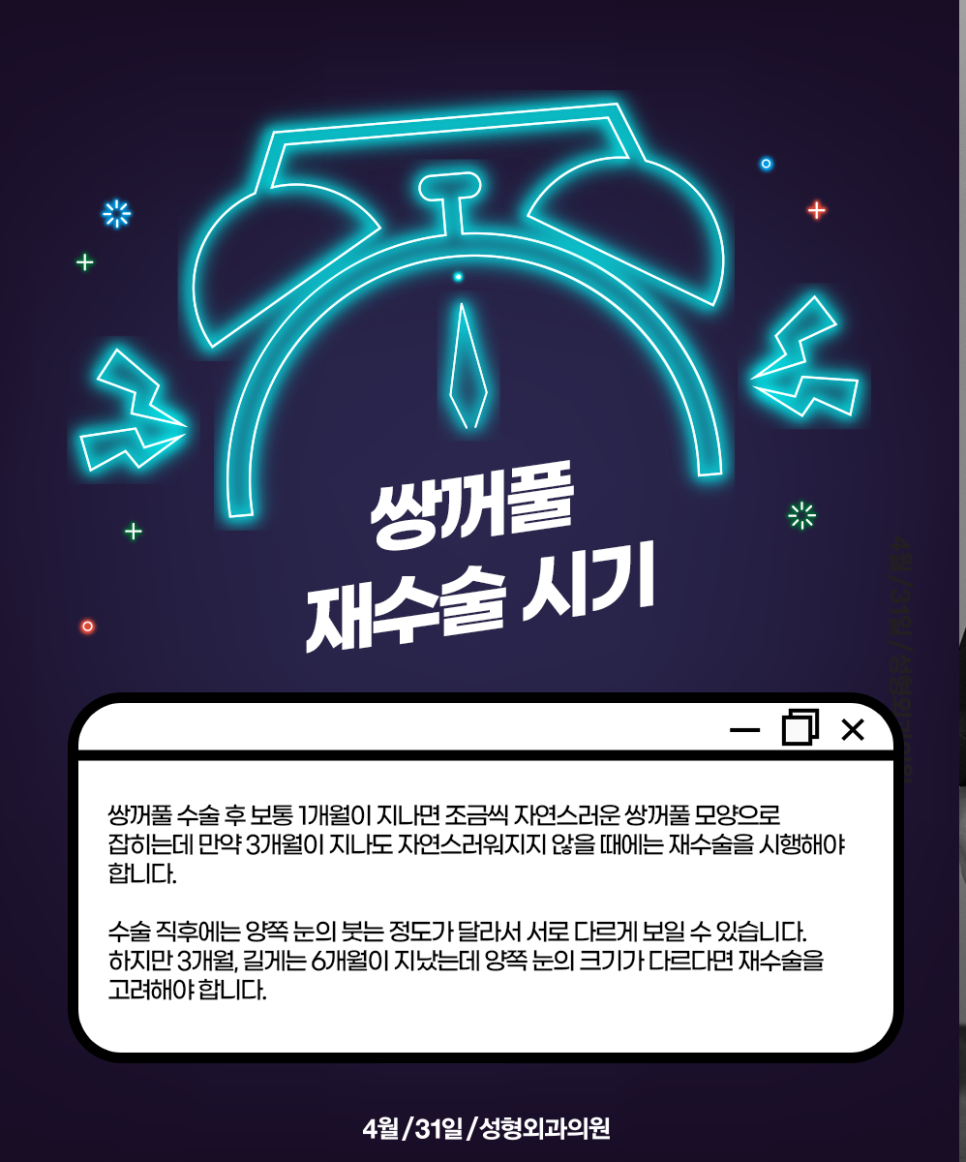 쌍꺼풀재수술유명한병원 후회없는 곳으로 관련 이미지 5