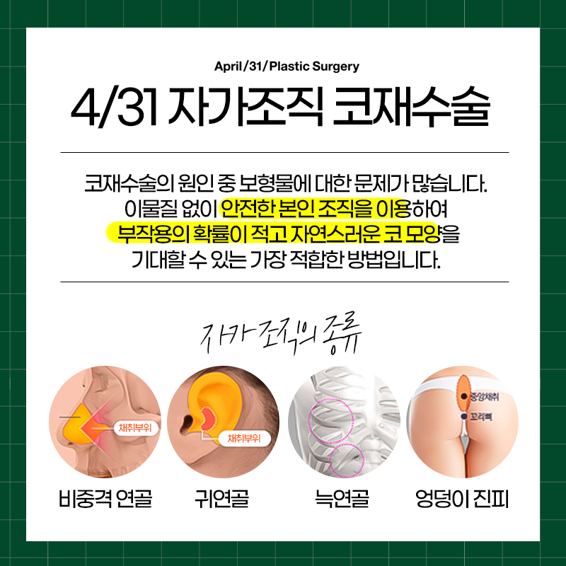 [Nose Revision Surgery] 4월31일 Plastic Surgery That Considers the Next 10 or 20 Years image 5