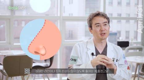 뭉툭한 코, 매부리코를 가지고 있다면 관련 이미지 7