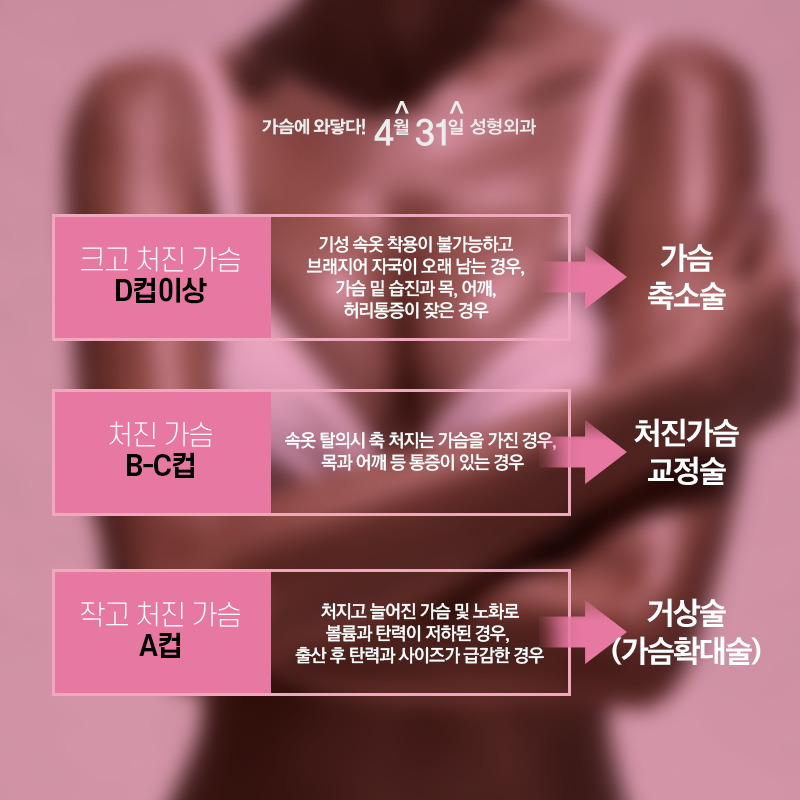 강남처진가슴수술잘하는곳 찾는다면 4월31일성형외과 관련 이미지 4