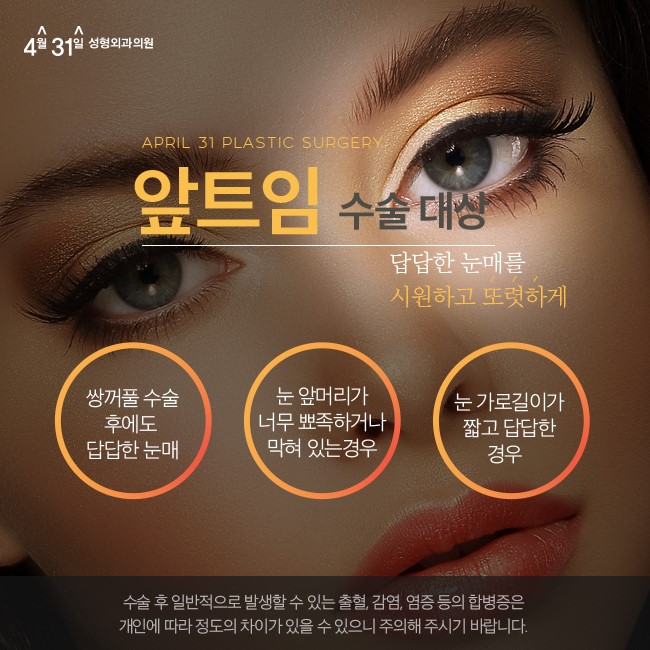 앞트임병원추천 4월31일성형외과 관련 이미지 3