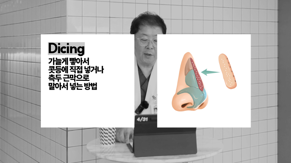 [Contracted Nose] Deep Analysis of the 5th Stage of Contracted Nose Correction / Part_04 Appropriate Grafting for the Nasal Bridge and Tip image 7