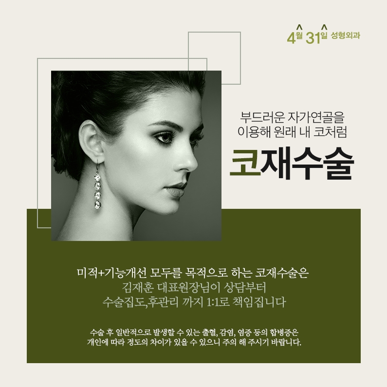 코재수술잘하는병원 4월31일성형외과의 만족감! 관련 이미지 2