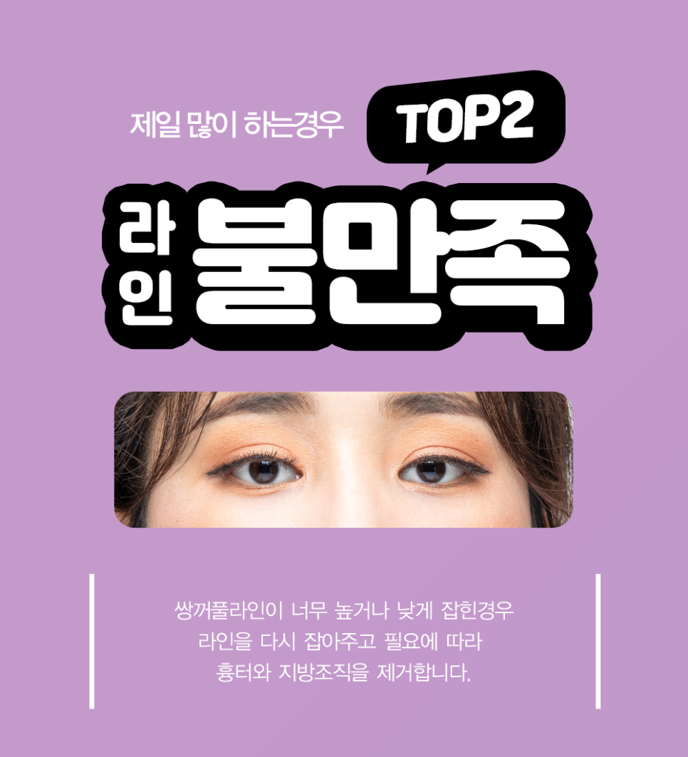 In What Cases Should You Consider Eye Revision Surgery at April 31 Plastic Surgery Clinic? image 3