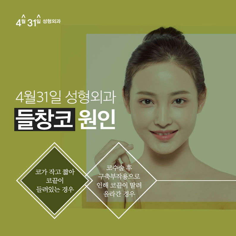 들창코재수술잘하는곳 4월31일성형외과에서 관련 이미지 3