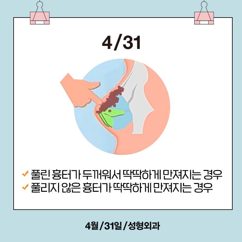 [Contracted Nose] Deep Analysis of the 5-Step Contracted Nose Correction Surgery Part 01_ Sufficient Dissection and Release image 6