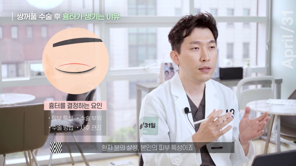 [Eye Plastic Surgery] The Dark and Light Sides of Eye Plastic Surgery - About Scars from Double Eyelid Surgery image 3