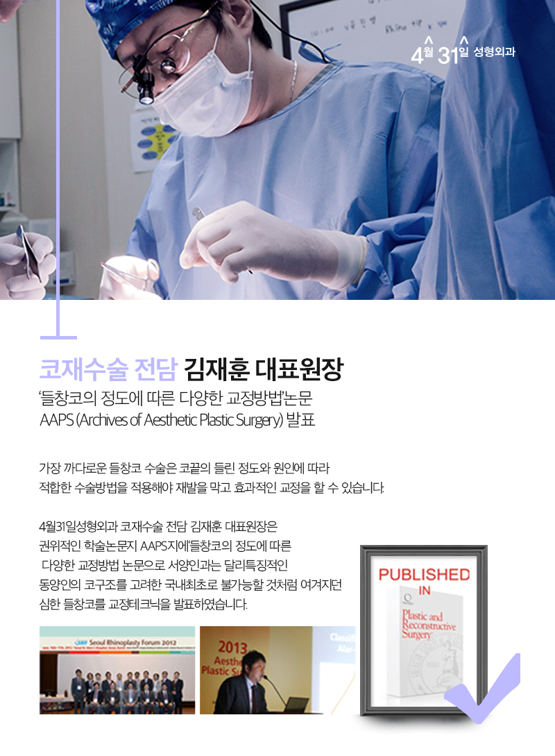 코재수술잘하는병원 4월31일성형외과인 이유? 관련 이미지 6