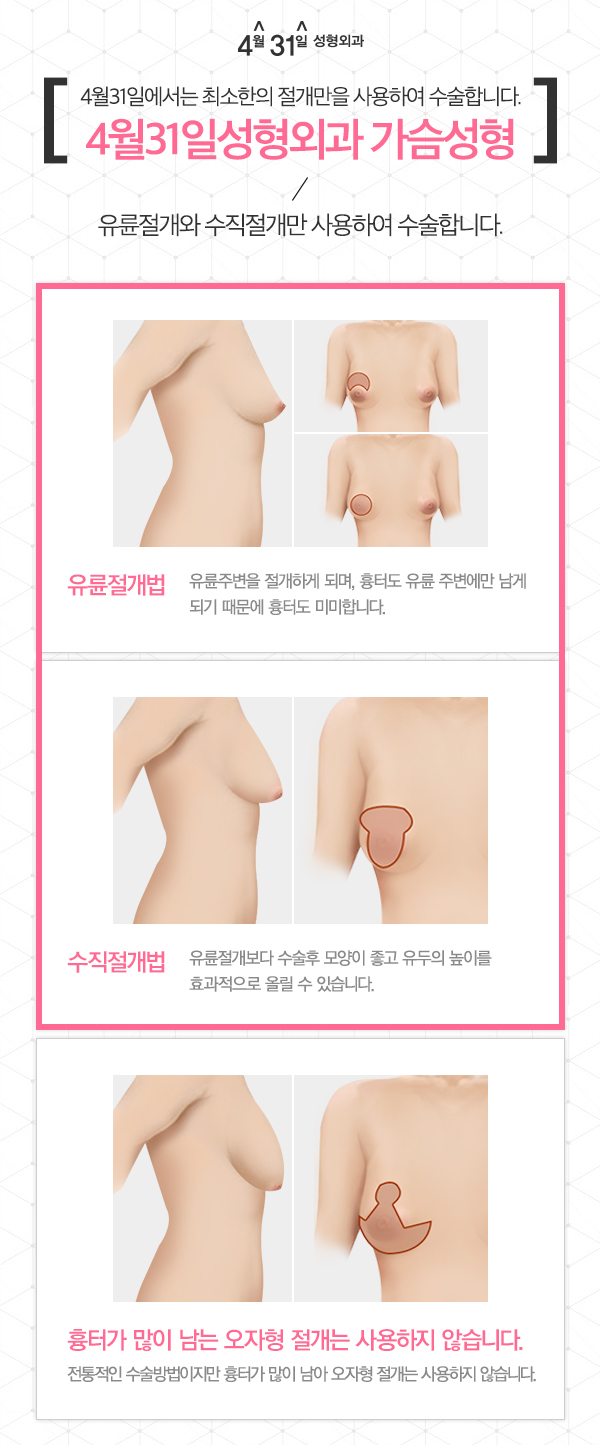 출산후처진가슴수술 4월31일 성형외과 입니다 관련 이미지 3