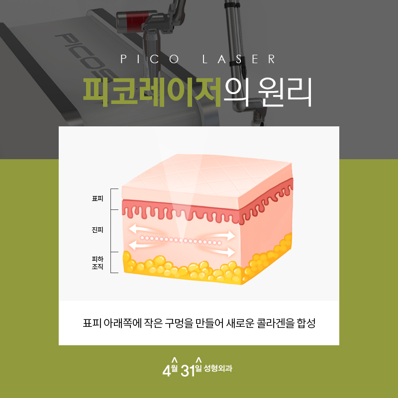 코모공축소 시술로 효과를 볼 수 있는 방법은 어떤 것이 있을까? 관련 이미지 7