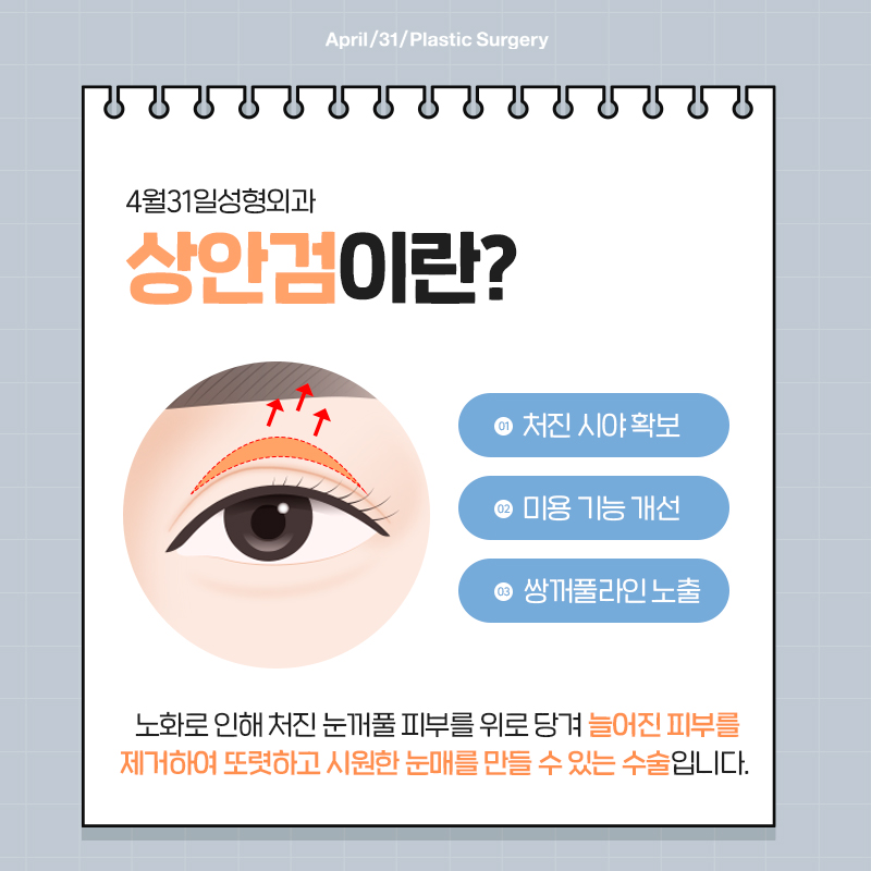 [눈성형] 처진 눈꺼풀 리프팅! 상안검 수술 관련 이미지 3