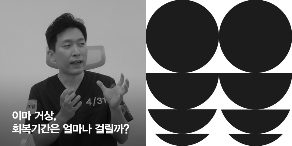 [April 31 Plastic Surgery] How Long Does the Recovery Period for a Forehead Lift Take? image 1