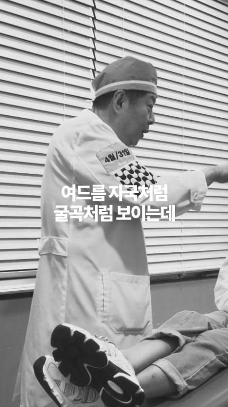 [4월31일성형외과] 코 재수술 후, 울퉁불퉁한 이유? 관련 이미지 6