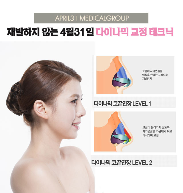 들창코수술비용 더이상의 고민 끝! 관련 이미지 3
