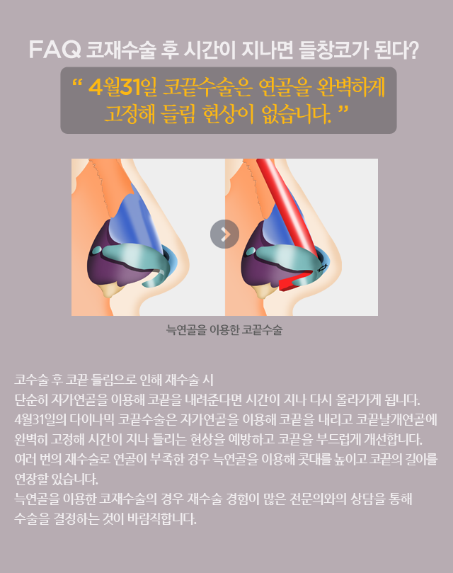 구축코성형 4월31일성형외과의원 책임진료 관련 이미지 1
