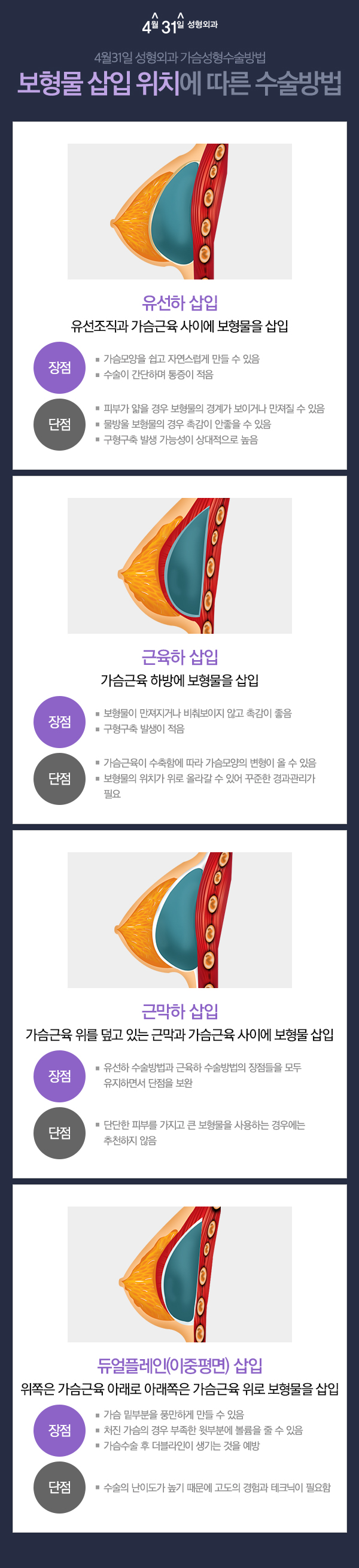 안전한가슴성형 4월31일성형외과 신뢰의 이유 관련 이미지 3