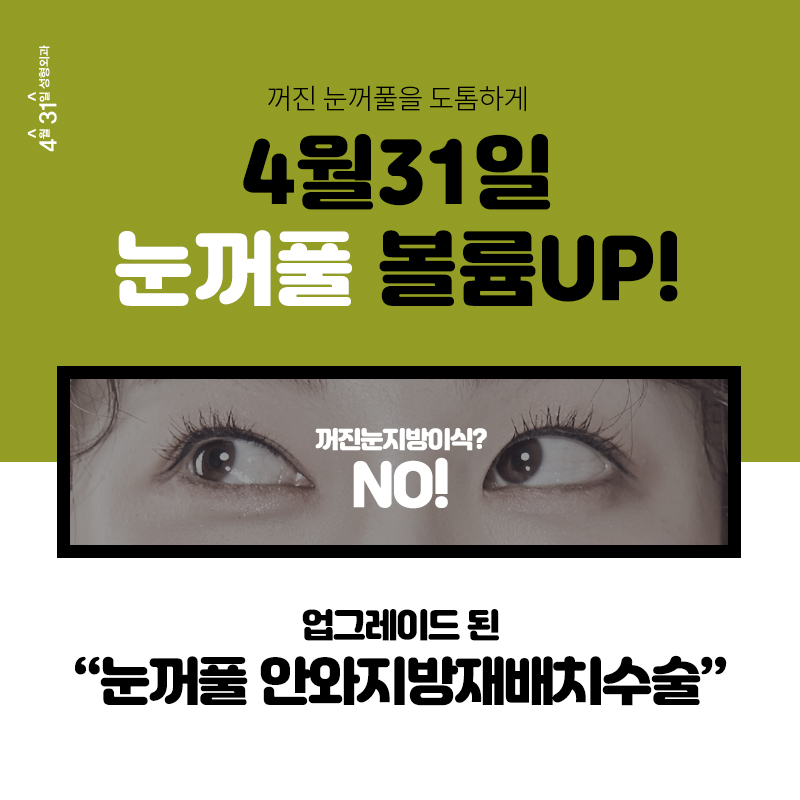 처진눈꺼풀수술효과 4월31일성형외과에서 업 관련 이미지 2