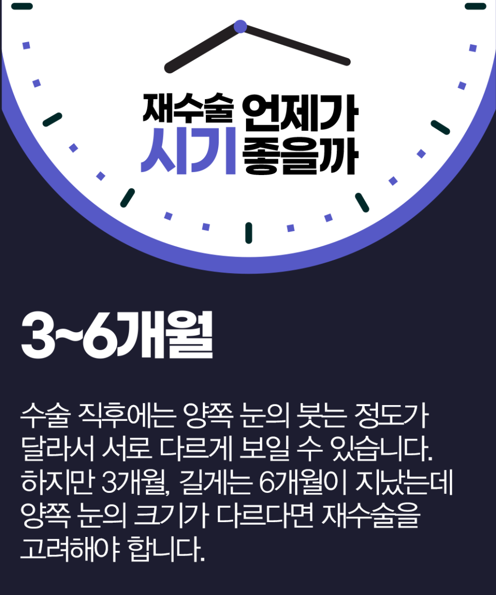 Because Revision Eye Surgery Is More Difficult Than the First, Start at April 31 Plastic Surgery image 3