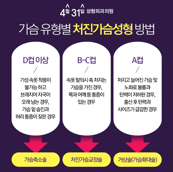 처진가슴수술은 4월31일성형외과 관련 이미지 3