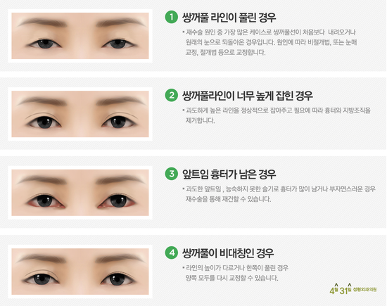 쌍수재수술병원 전담의료진 있는 4월31일성형외과의원 추천 관련 이미지 2