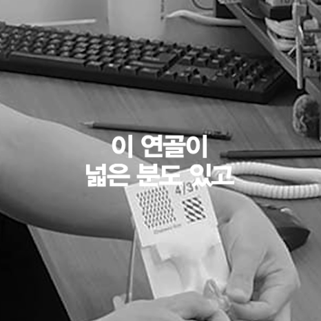 [4월31일성형외과] 코 성형했는데 왜 코끝이 뭉툭해 보일까요? 관련 이미지 5