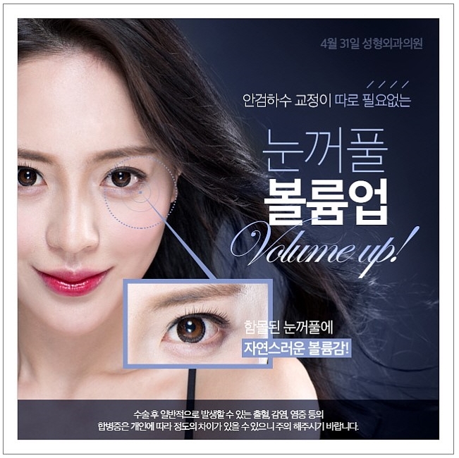 꺼진눈성형 볼륨있는 동안눈매 관련 이미지 1