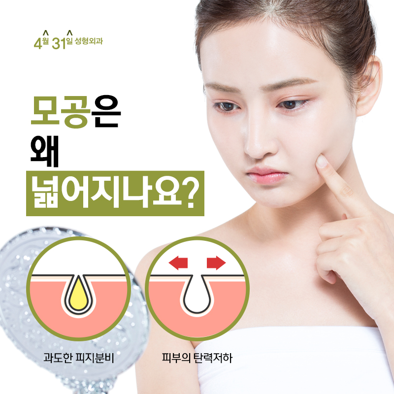 나비존 조여주는 모공축소레이저를 선택한다면? 관련 이미지 2