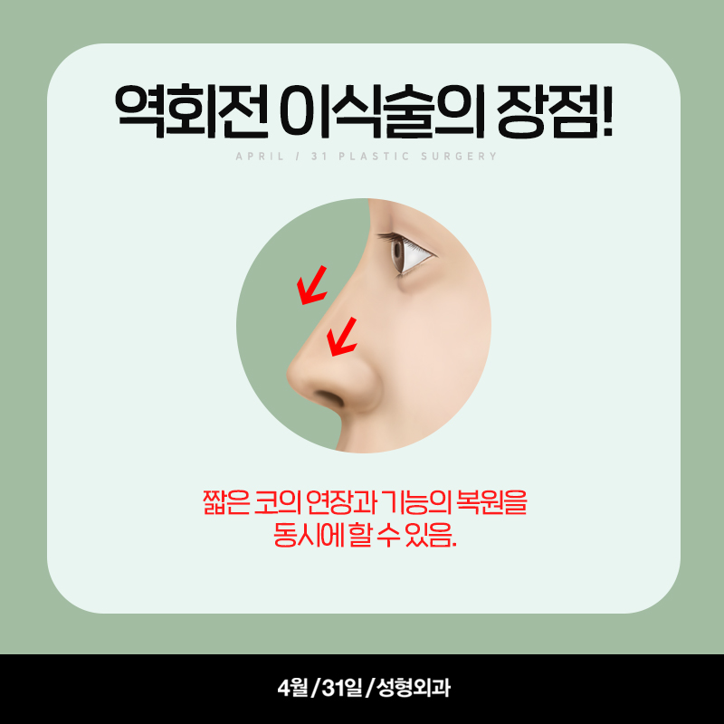 [구축코] 구축코 교정술 5단계 심층분석 Part03_이완시킨 연골 구조의 고정 관련 이미지 5
