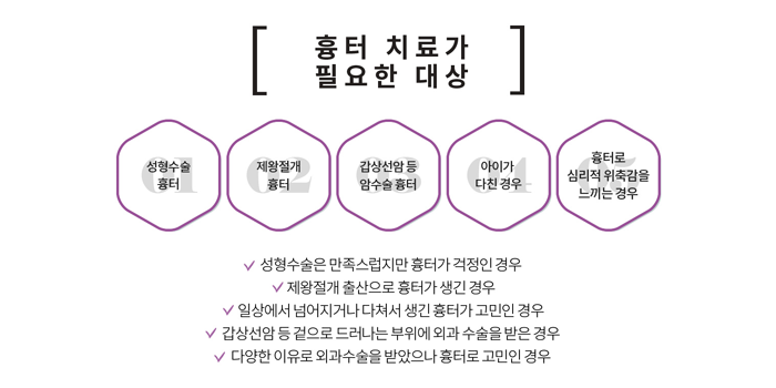 강남흉터치료 수술 흉터까지 4월31일성형외과 관련 이미지 2