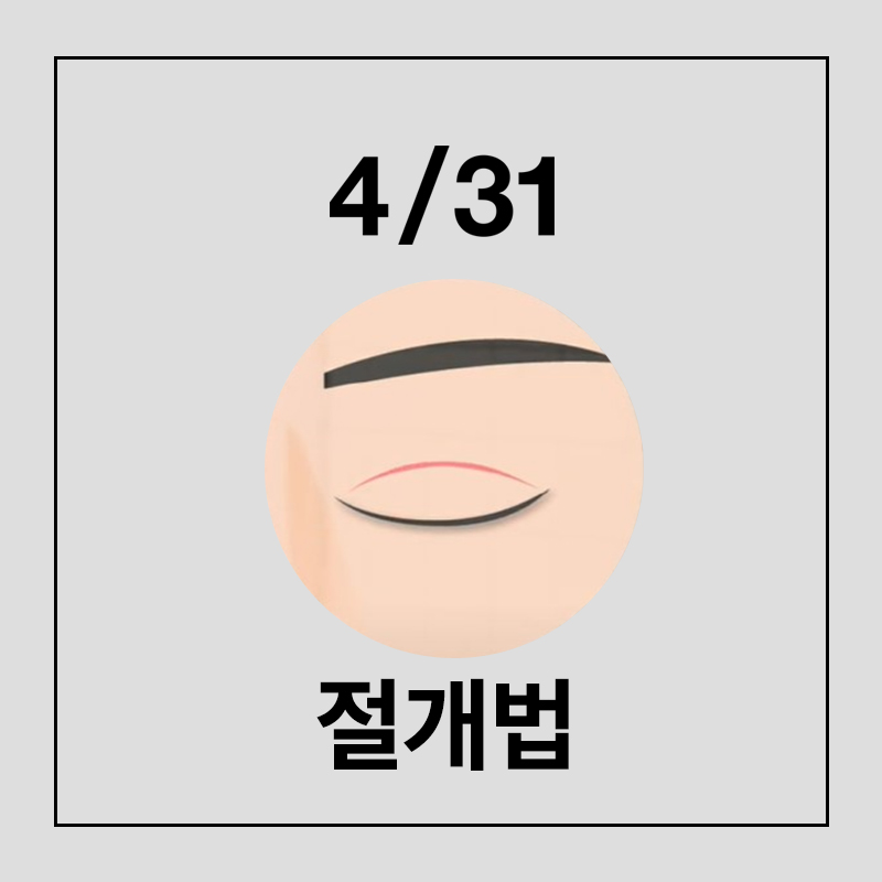 풀릴걱정 없는 4/31의 눈성형, 절개법 관련 이미지 3