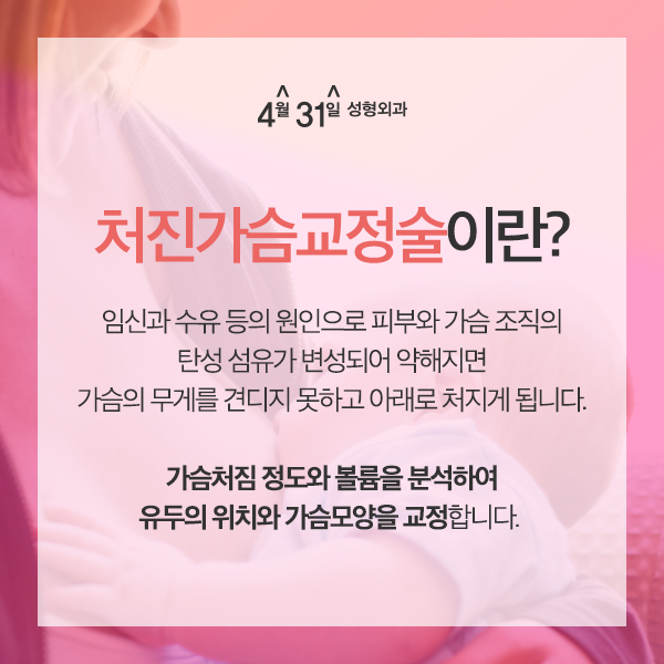처진가슴성형비용 4월31일성형외과의원에서 부담 없이 관련 이미지 1