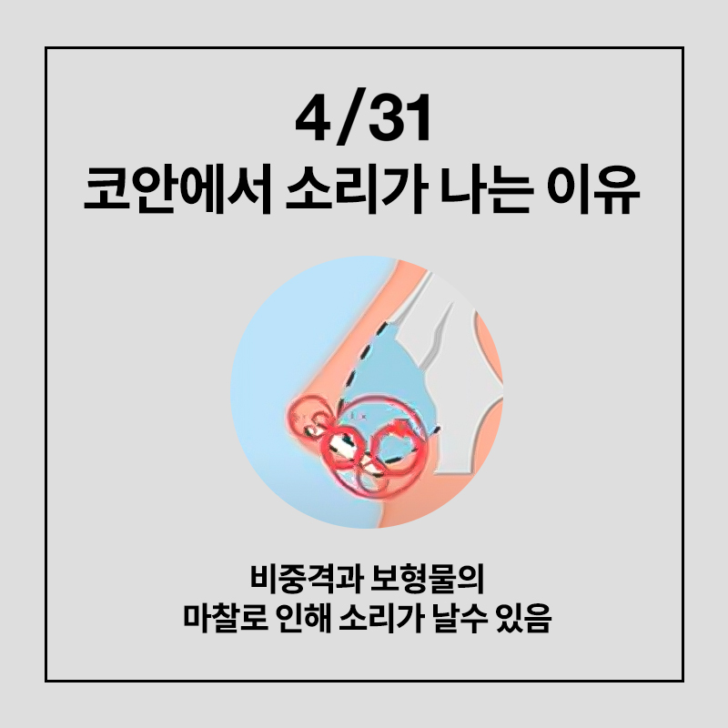 [코성형] 코수술 후 냄새나고, 딱딱 소리가 난다? 관련 이미지 4