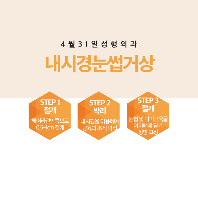 눈썹거상술후기 좋은 이유가 있었네! 관련 이미지 3