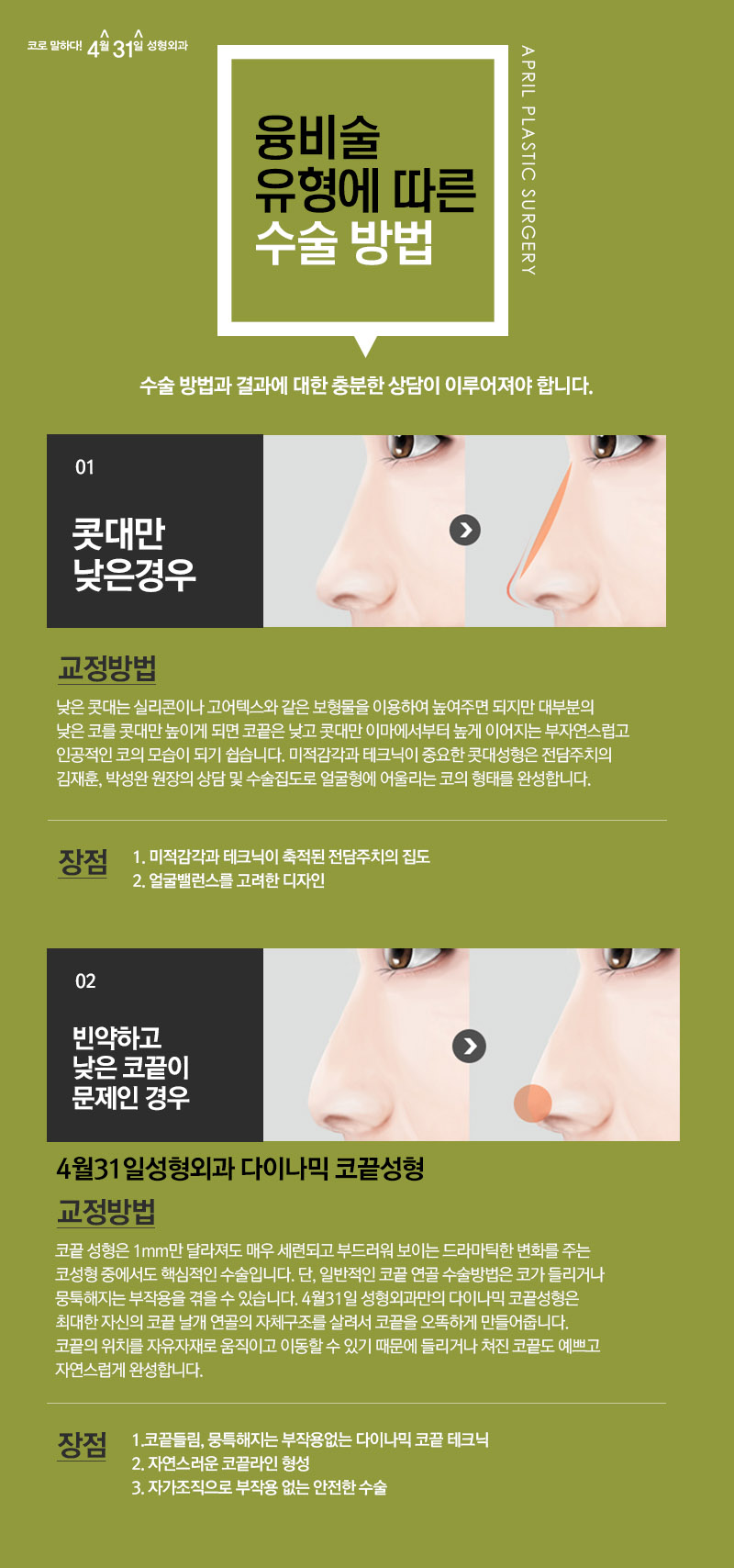 융비술 강남코성형 자연스러운 콧대로 이미지개선! 관련 이미지 3
