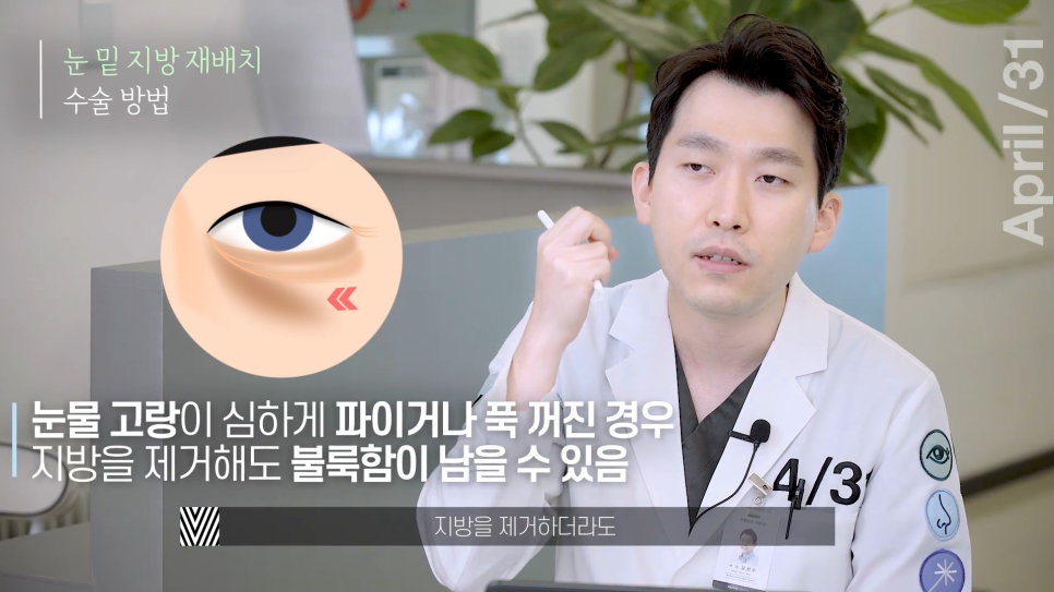 Lower Eyelid Fat Repositioning vs. Lower Eyelid Fat Removal: Which Should You Choose? image 6