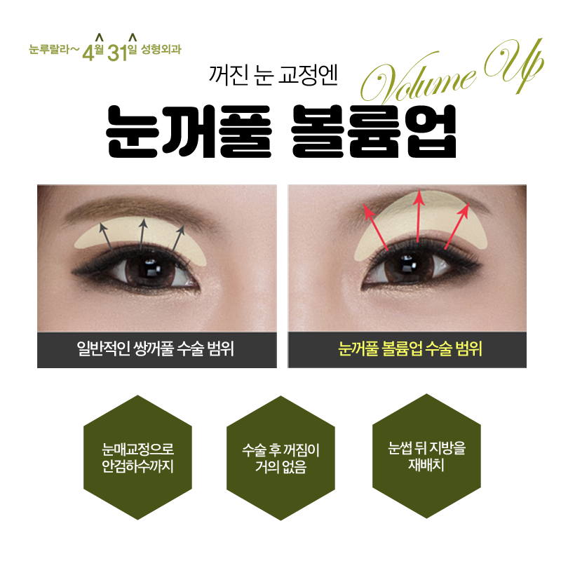 Sunken Eye Correction, April 31 Eyelid Volume Up: Bring Sunken Eyes Back to Life image 6