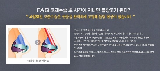 코성형 재수술 전문 신뢰할수 있는곳! 관련 이미지 4