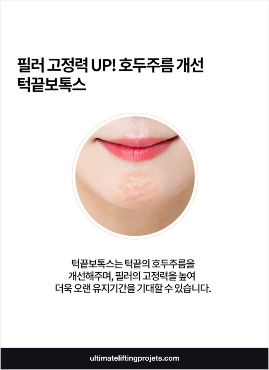 턱끝필러+턱끝보톡스(자갈턱보톡스) 2가지 시술로 효과 2배 UP! 관련 이미지 4