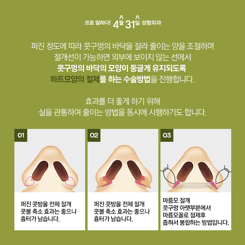 콧볼축소수술비용 합리적인 비용과 탄탄한 실력 관련 이미지 4