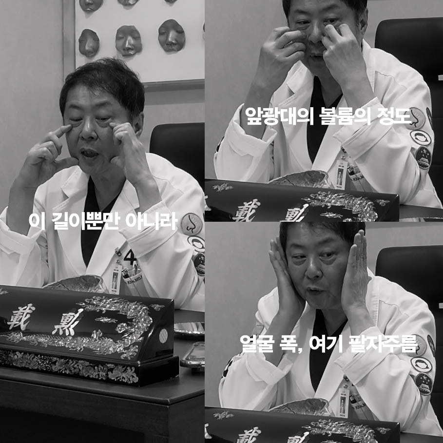 [4월31일성형외과] 콧구멍이 안보이면 중안부가 길어 보일까? 관련 이미지 6