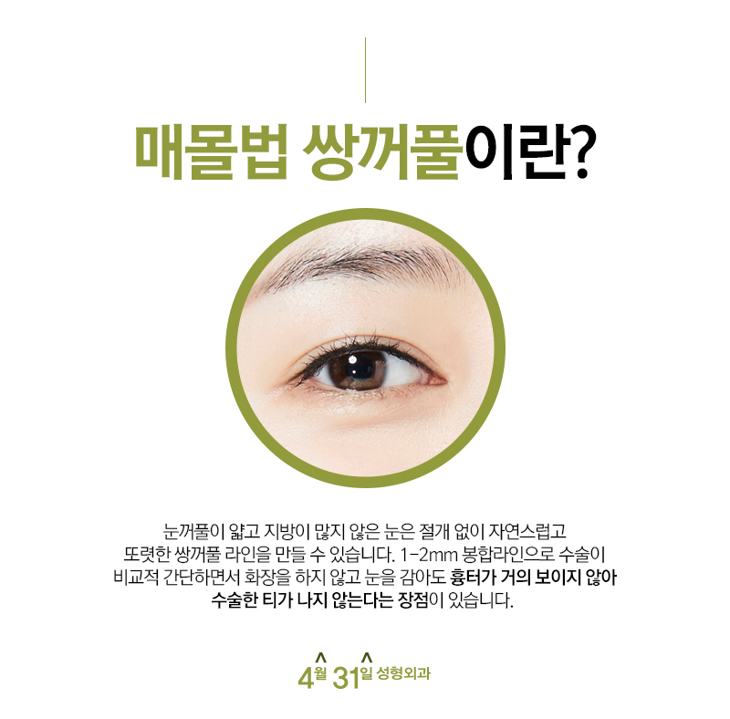 쌍수매몰잘하는곳 빠르지만 안전지향적이게 관련 이미지 2