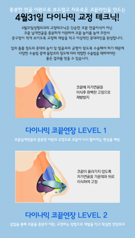 들린코성형 해야할 땐 4월31일성형외과의원 관련 이미지 2