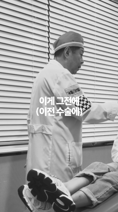 [4월31일성형외과] 코 재수술 후, 울퉁불퉁한 이유? 관련 이미지 2