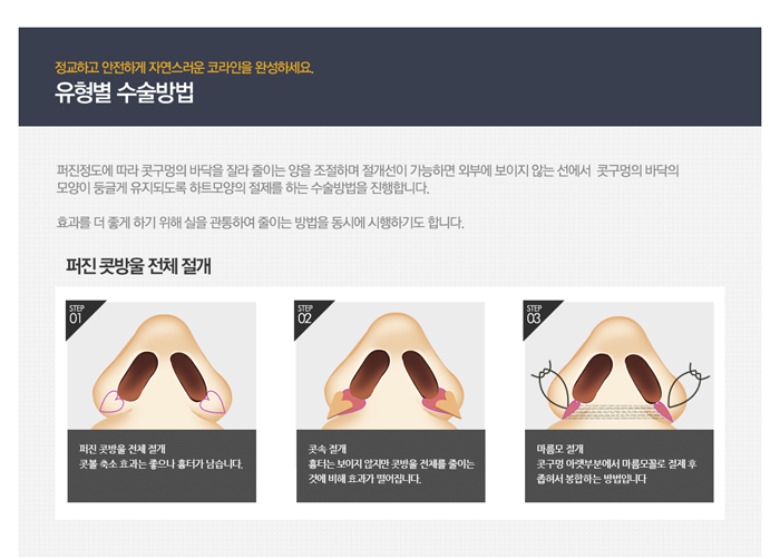 콧볼축소잘하는곳 4월31일성형외과만 믿으세요! 관련 이미지 3