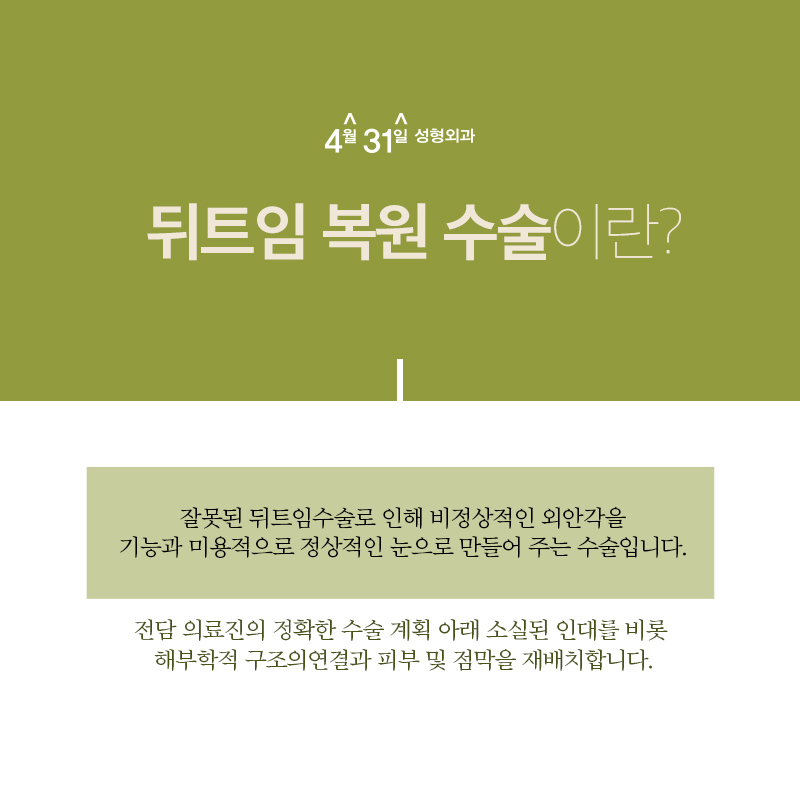 뒤트임복원 4월31일성형외과에서 해결하세요 관련 이미지 2