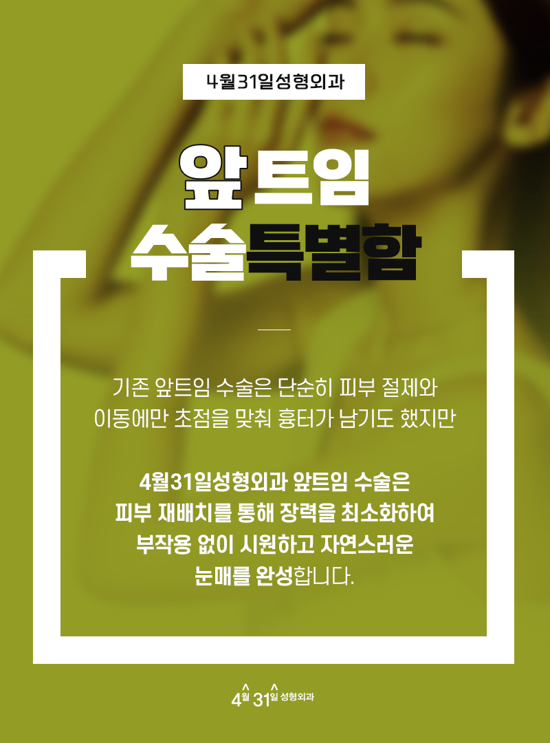 앞트임성형 답답함을 없애요 관련 이미지 3